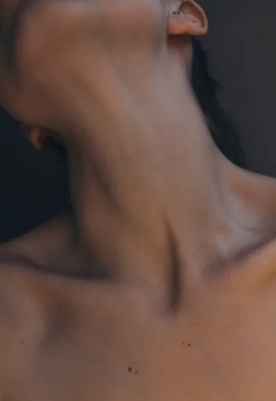 Lipo de cuello como parte de tratamientos complementarios al lifting facial para una apariencia más joven. Definición del contorno cervical lograda con liposucción de cuello, ideal para potenciar resultados de lifting facial.