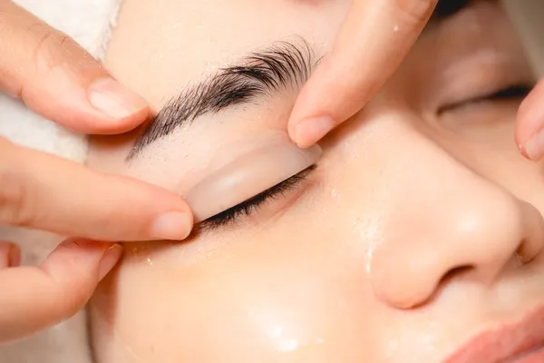 Párpados superiores e inferiores definidos tras cirugía estética ocular que complementa un lifting facial. Resultados de blefaroplastia como tratamiento complementario al lifting facial para rejuvenecer la mirada.