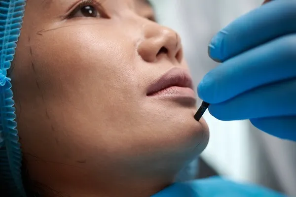 Más allá del Lifting Facial: tratamientos complementarios para lucir aún mejor