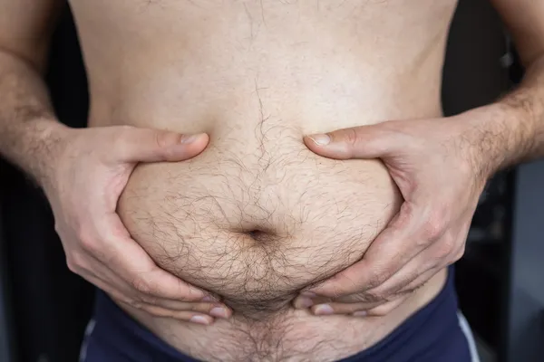 Acercamiento al abdomen de un hombre con vellos que sostiene su panza mostrando grasa localizada antes de la lipoescultura hombre