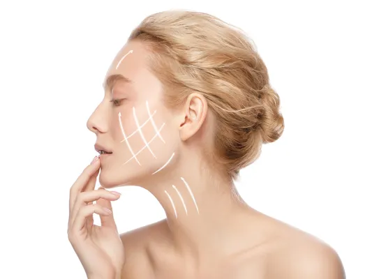 Mujer joven de perfil con piel lisa y líneas gráficas blancas en el rostro que representan las zonas de aplicación de un lifting facial sin cirugía