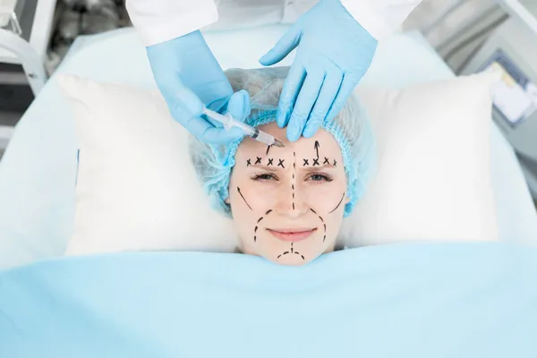 Mujer de edad madura recostada en una camilla clínica con marcas hechas por el cirujano en el rostro como preparación para un procedimiento de lifting facial