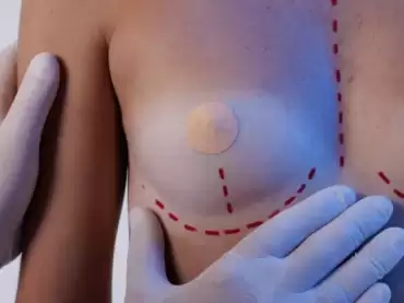 ¿Cuánto cuesta una operación de senos en México? Precios, tipos y factores clave