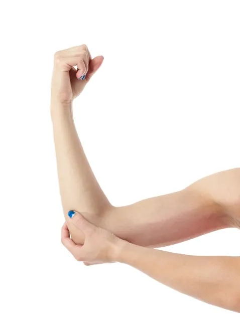 Brazo de mujer mostrando la zona del tríceps donde se aplica habitualmente la técnica de lifting de brazos profesional