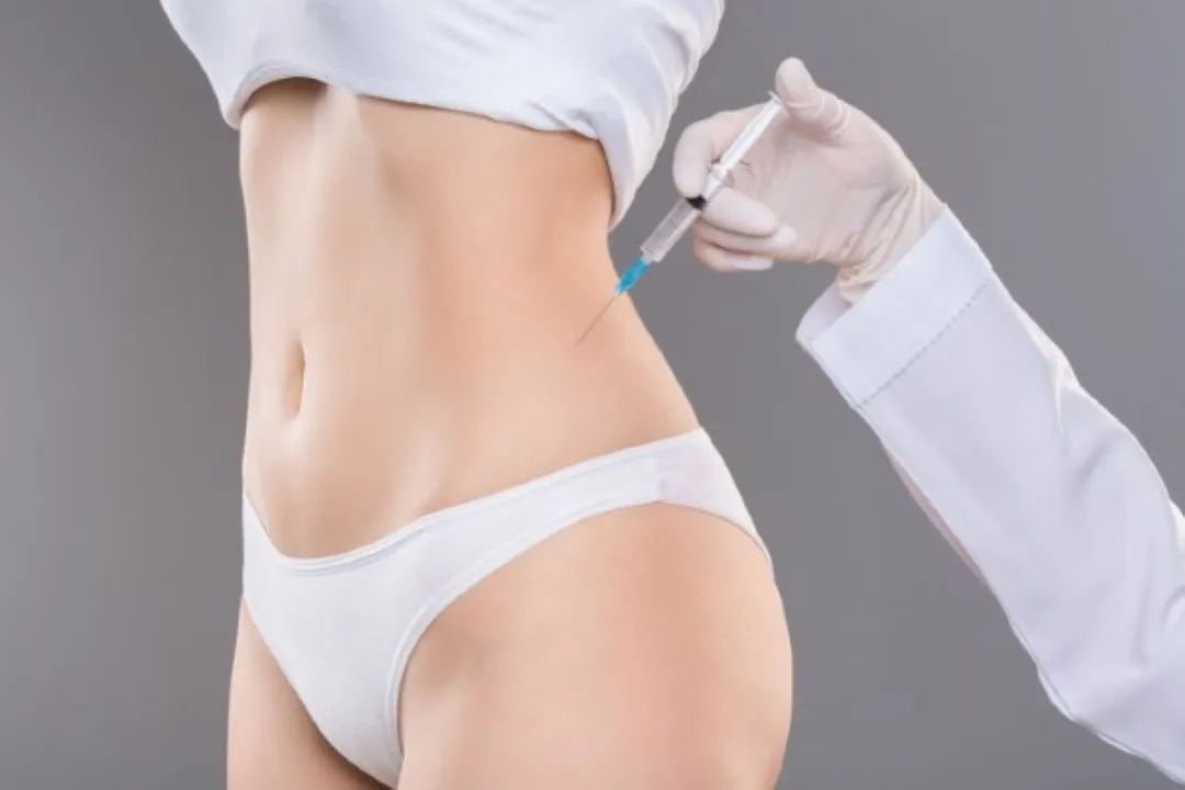 Procedimiento estético de cirugía plástica en caderas con técnica de inyección.