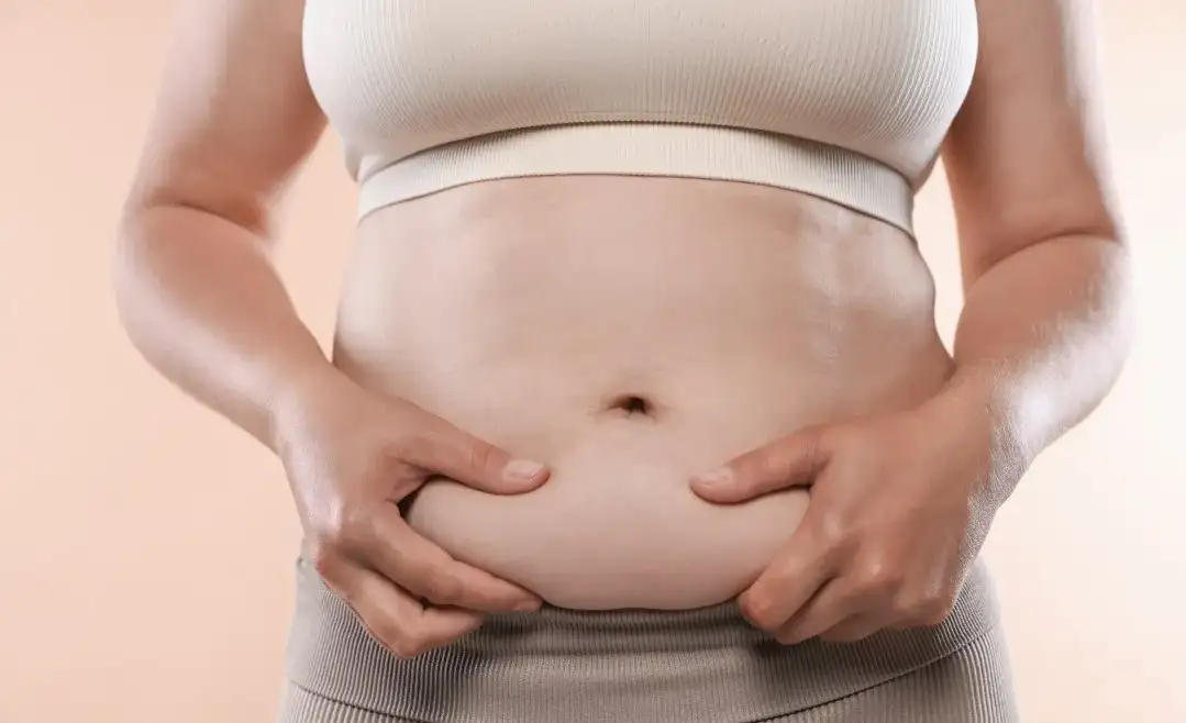 ¿Cuánto cuesta una abdominoplastia en México?