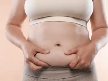 ¿Cuánto cuesta una abdominoplastia en México?