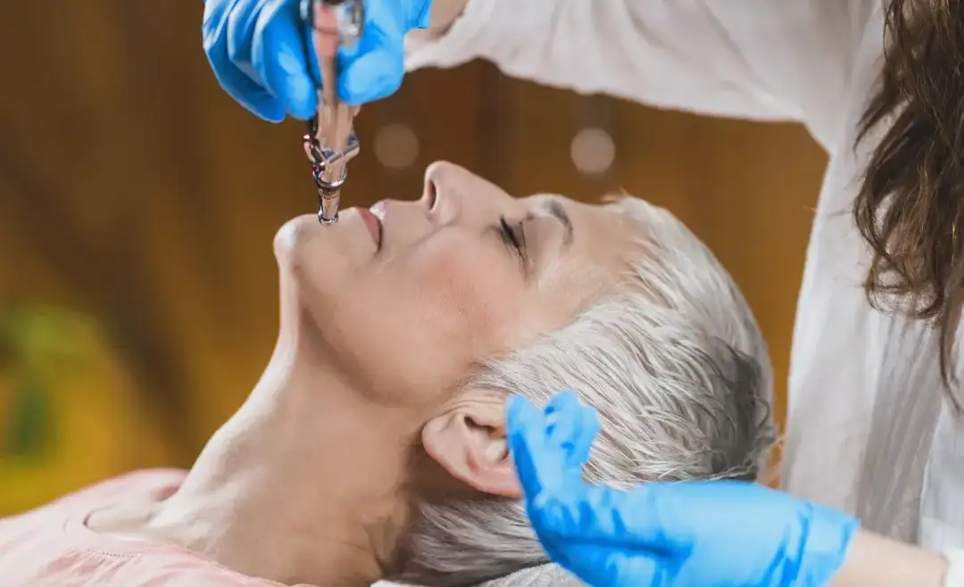 Lifting facial sin cirugía: Las 5 mejores alternativas para rejuvenecimiento facial